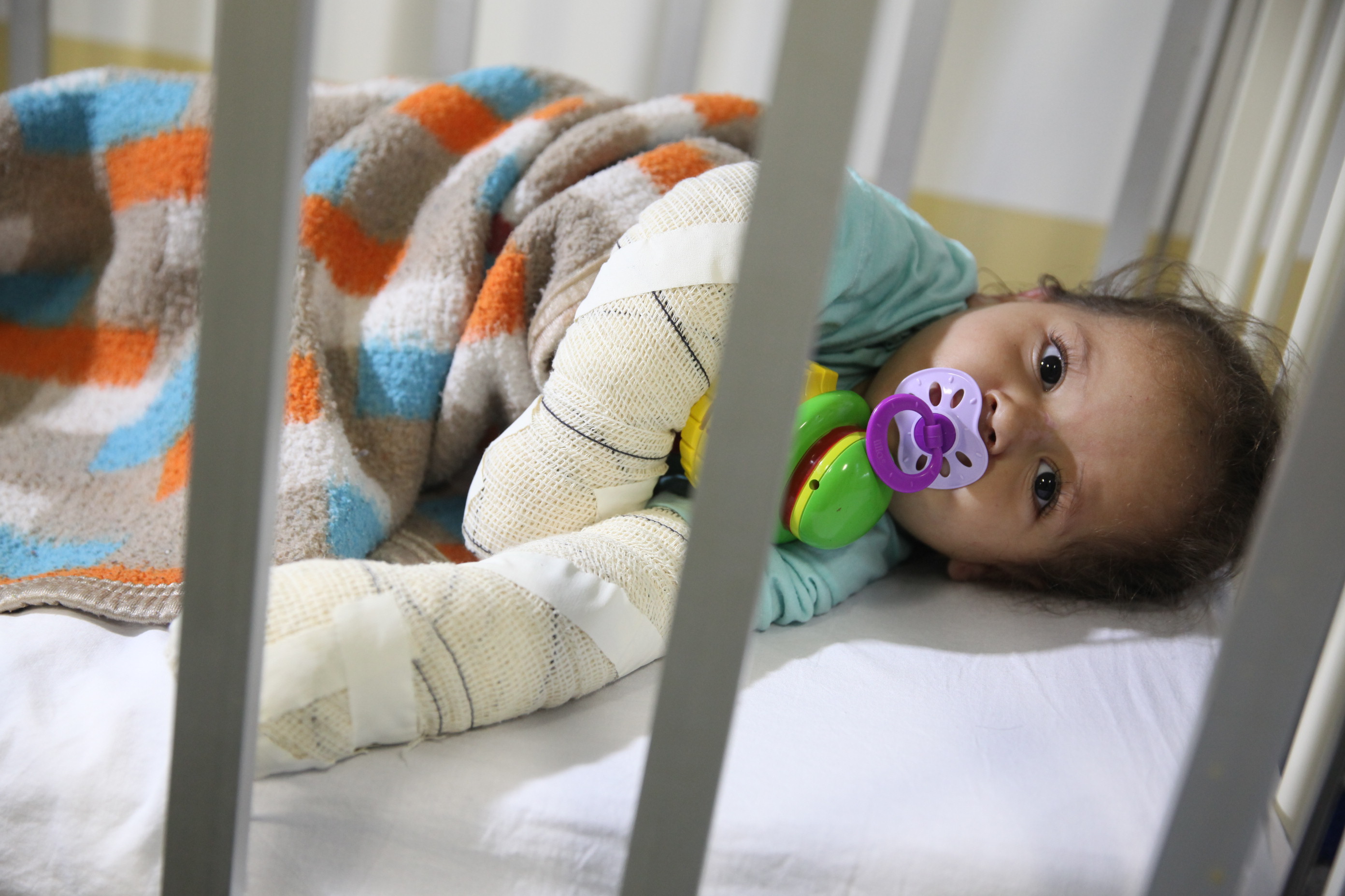 Hospital Joana de Gusmão - Queimados - Gabrielly, vítima de incêndio na casa dos pais em Itajaí -  Foto: Lucas Gabriel Diniz / Agência AL