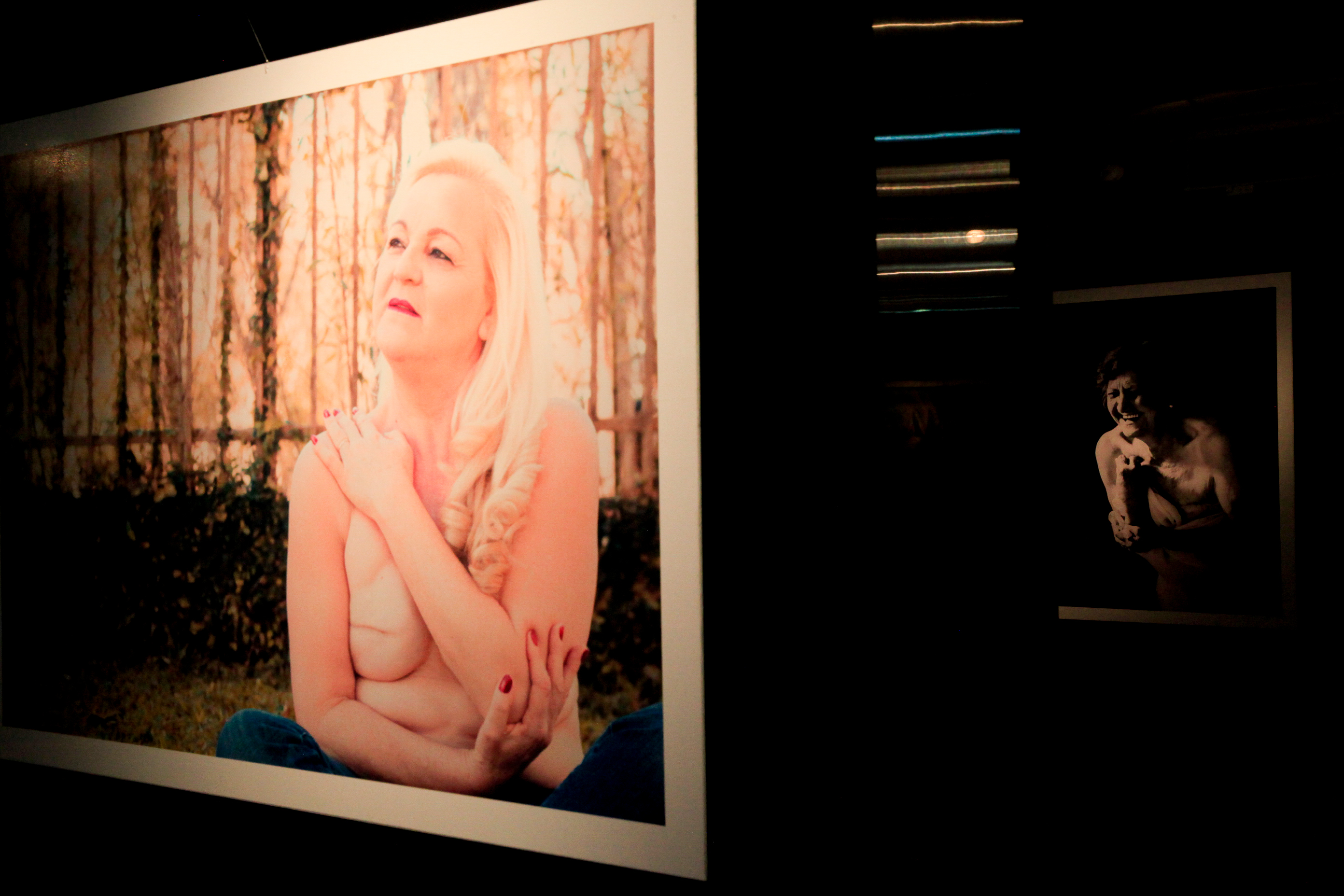 Exposição Cicatrizes